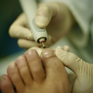 toenail-6157928_640 Ingegroeide Teennagel: Wat Is Het, Hoe Herken Je Het en Wat Kun Je Eraan Doen?