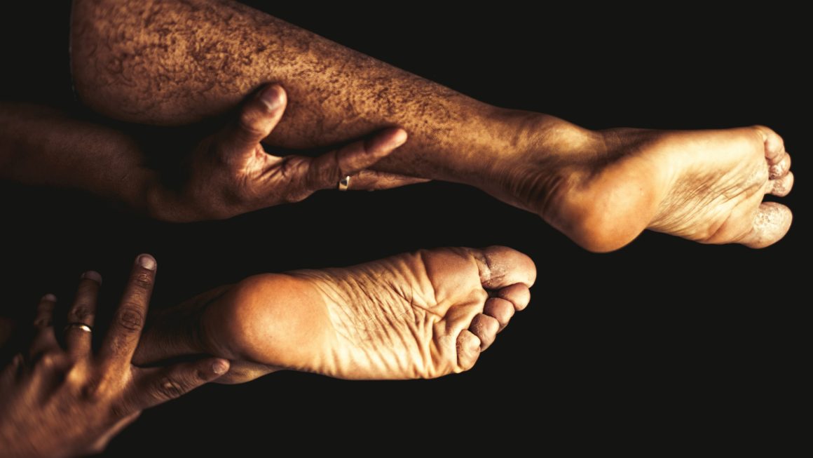 Zorgwol-Blog-Eczeem Eczeem - Zorgwol