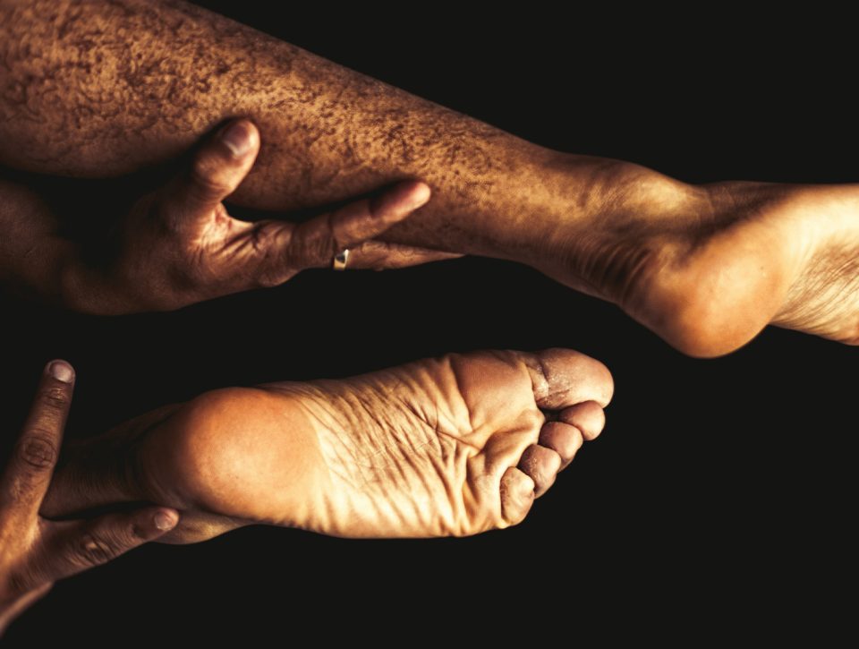 Zorgwol-Blog-Eczeem Eczeem - Zorgwol