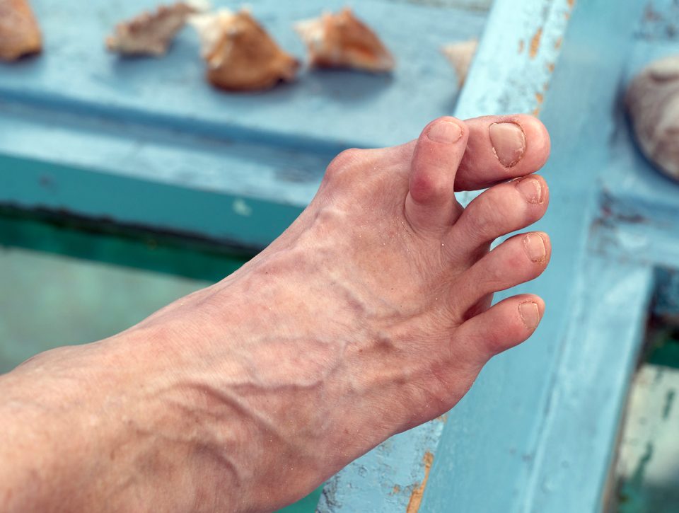 Zorgwol-Blog-Hamerteen Hamerteen - Zorgwol