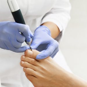 Pedicure - Zorgwol